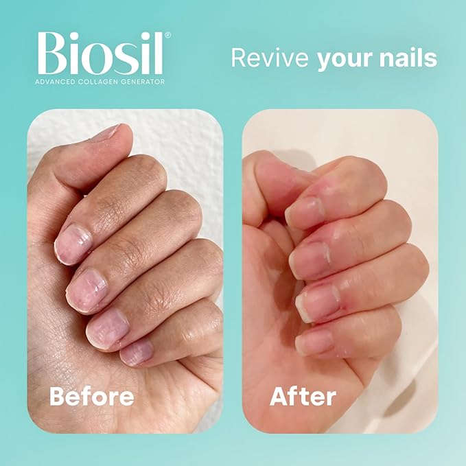 Biosil Collagen Generator - 30 Original Capsules - with Patented ch-OSA Complex - Generates & Protects Your Own Collagen - GMO Free - 15-Day Supply