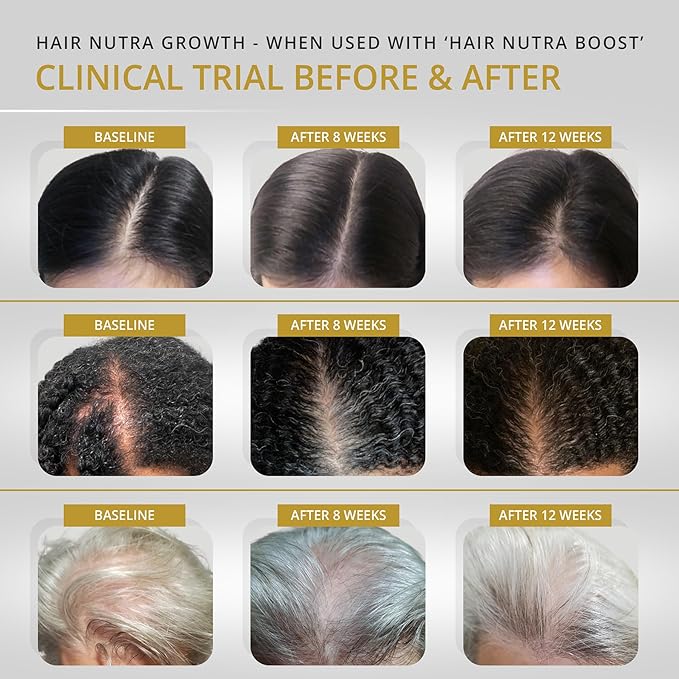 VITAMINS REVIVE Hair Supplement Hair Growth Vitamins for Women - USA Clinically Tested - Hair Loss Products for Thinning & Thickening - Female Hair Regrowth Treatment (1 Month Supply)