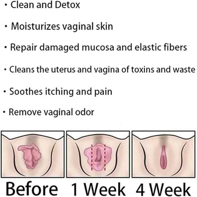 Instant Anti-Itch Detox Products, Capsulas, Firming Repair & Pink and Tender Natural Capsules, Capsulas (5Bag)