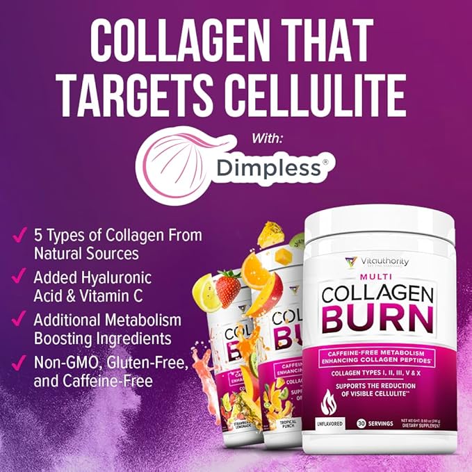 Vitauthority Collagen Peptides Powder Weight Loss | Collagen Supplements Hydrolyzed Beauty Complex | Multi Collagen for Women, Hair Skin Nails | Fat Burning Support | Chocolate Flavored 25 Servings