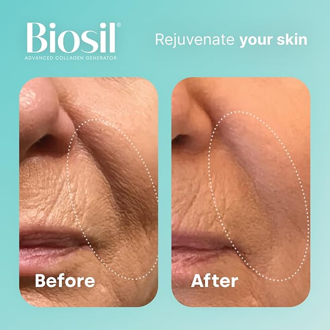 Biosil Collagen Generator - 60 Liquid Capsules, Pack of 2 - with Patented ch-OSA Complex - Generates & Protects Your Own Collagen - GMO Free - 60-Day Supply