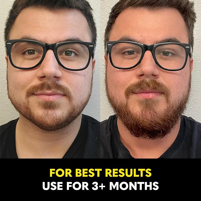 Beard Club Biotin Vitamin Spray for Facial Hair Growth - Natural Formula for Fuller, Thicker Beard, Easy-to-Use, Nourishing & Soothing for All Beard Types & Skin